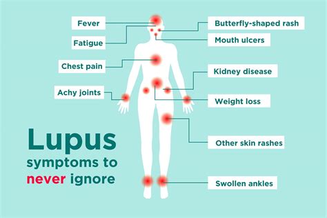 síntomas de lupus - caldo de pollo telegram